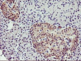 TMOD1 / Tropomodulin 1 Antibody (clone OTI2C2)
