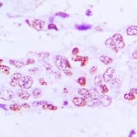 Polyclonal Rabbit anti-Human GSK3 Alpha+Beta Antibody (phospho-Tyr279/Tyr216, IHC, WB)