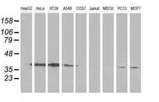 ANXA3 / Annexin A3 Antibody (clone OTI1A5, Carrier-free)