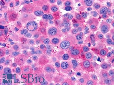 PathPlus™ LGR6 Antibody (N-terminal extracellular domain)