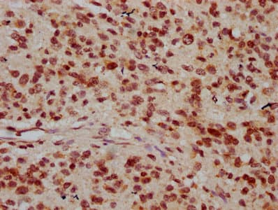 Polyclonal Rabbit anti-Human HIST1H1C Antibody (IHC)