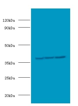 IHC-plus™ CSNK2A2 Antibody