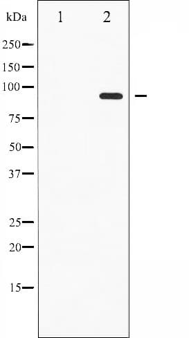 STAT6 Antibody (phospho-Thr645)