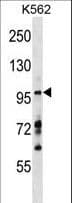 MYRIP Antibody (aa659-686)