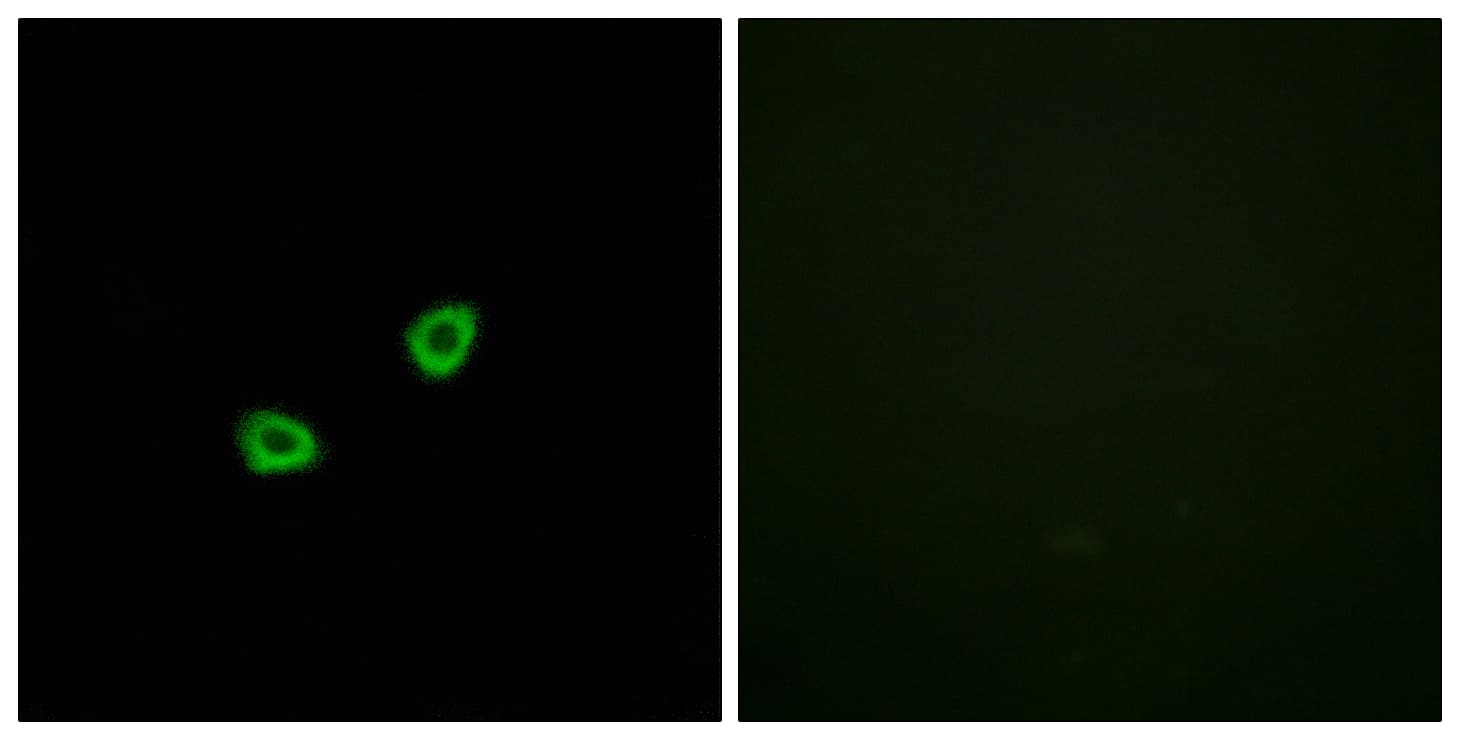 OR1L6 Antibody (aa111-160)
