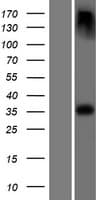 EPM2A / Laforin Protein (Over-Expression Lysate Myc-DDK (Flag))