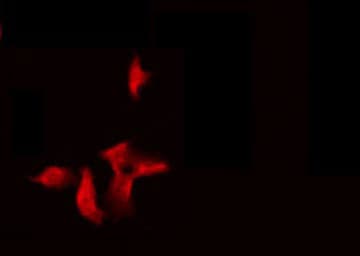 NBPF5P Antibody