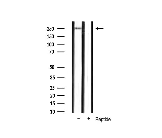 MTOR Antibody (phospho-Ser2448)