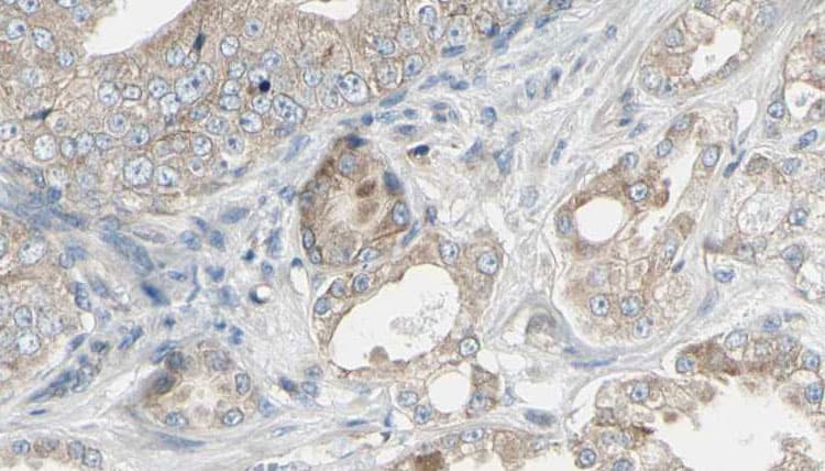 Polyclonal Rabbit anti-Human TRAF1 Antibody (IHC, WB)
