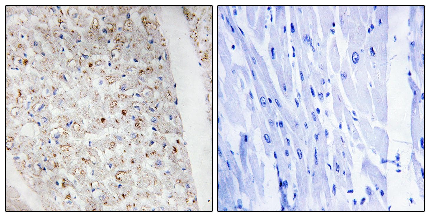PRKD1 / PKC Mu Antibody (phospho-Ser738+Ser742)