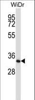 XPA Antibody (aa185-213)