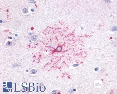 PathPlus™ FPR2 / FPRL1 Antibody (C-Terminus)
