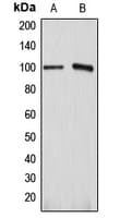IHC-plus™ ATP1A1 Antibody (Internal)