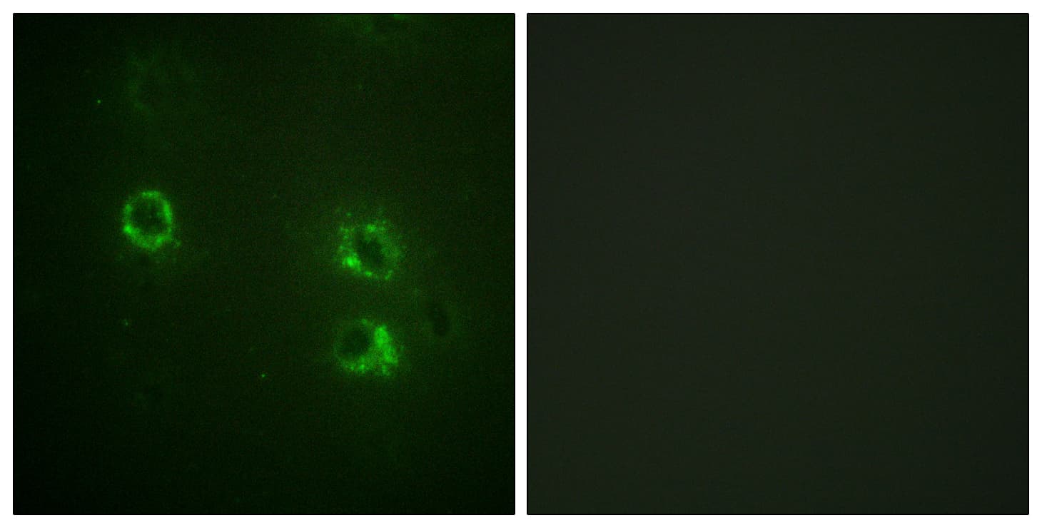 SYN1 / Synapsin 1 Antibody (aa576-625)