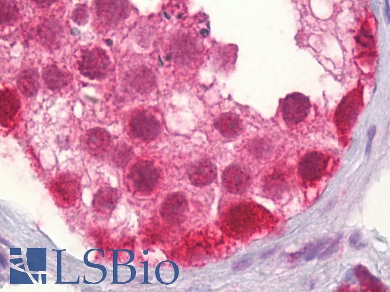 IHC-plus™ CUL2 / Cullin 2 Antibody (aa696-745)