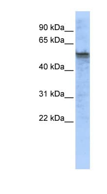 TPH2 Antibody (C-Terminus)
