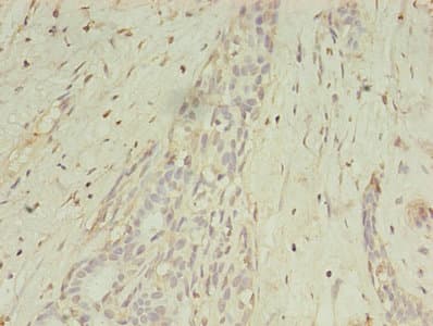 MAGE10 / MAGEA10 Antibody (aa2-225)