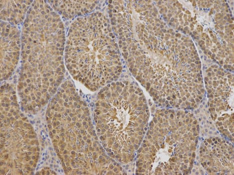 IHC-plus™ TCP1 Antibody