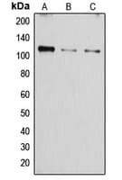ATP2A1 / SERCA1 Antibody (Internal)