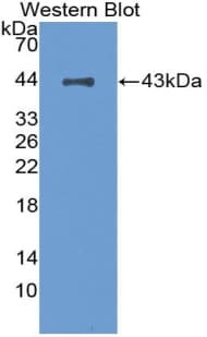CFH / Complement Factor H Antibody (aa860-1231)