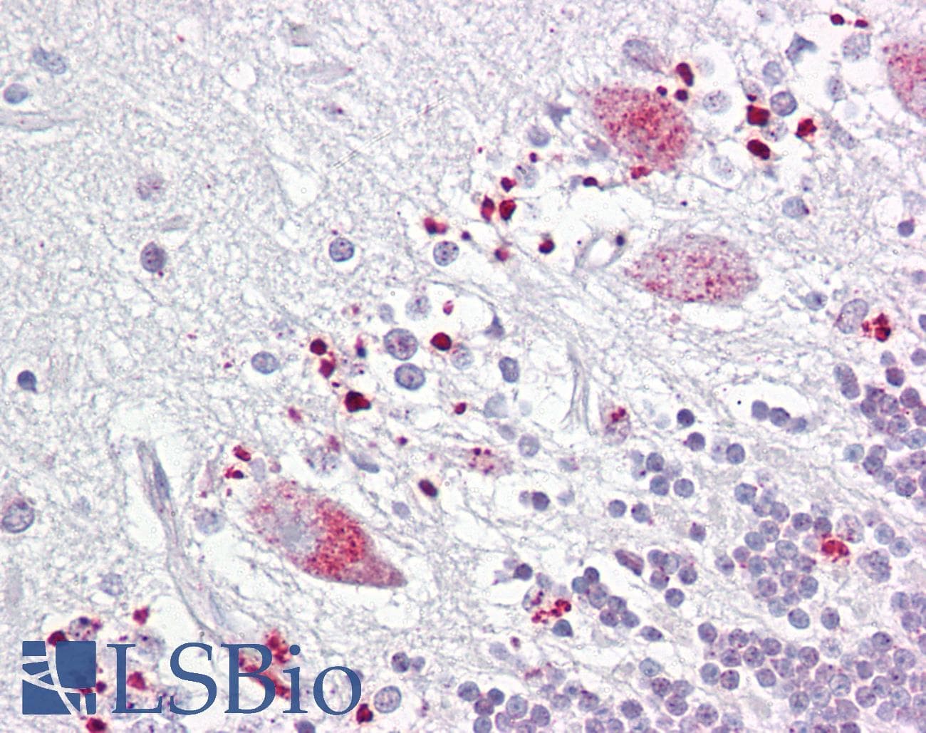 IHC-plus™ TIGAR Antibody (aa140-190)