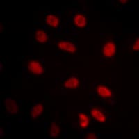 Polyclonal Rabbit anti-Human HSF1 Antibody (Internal, IHC, IF, WB)