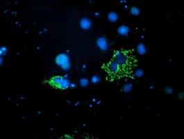 Monoclonal Mouse anti-Human PDSS2 / DLP1 Antibody (clone OTI1E9, IHC, IF, WB)