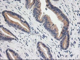 BAIAP2 / IRSP53 Antibody (clone OTI8G8)