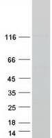 Human HAUS6 / FAM29A Protein (Recombinant Myc-DDK (Flag))
