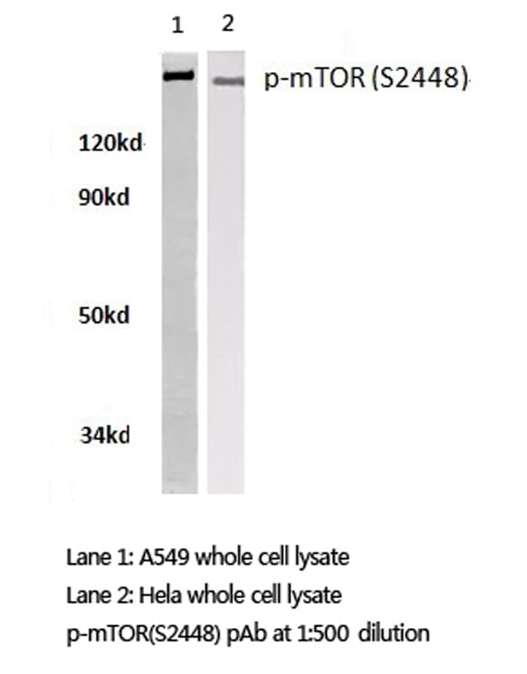 Polyclonal Rabbit anti-Human MTOR Antibody (phospho-Ser2448, IHC, WB)