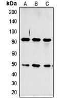 CCKAR / CCK1R Antibody (Internal)