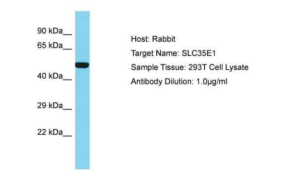 Polyclonal Rabbit anti-Human SLC35E1 Antibody (aa322-371, WB)