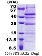Human ELP5 Protein (Recombinant His)