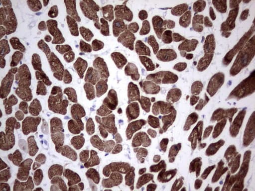 TNNC1 / Cardiac Troponin C Antibody (clone OTI8F8)