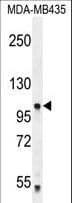PCDHA5 Antibody (aa287-315)