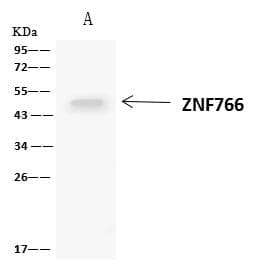 Polyclonal Rabbit anti-Human ZNF766 Antibody (IHC, WB)