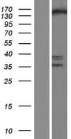ESET / SETDB1 Protein (Over-Expression Lysate Myc-DDK (Flag))