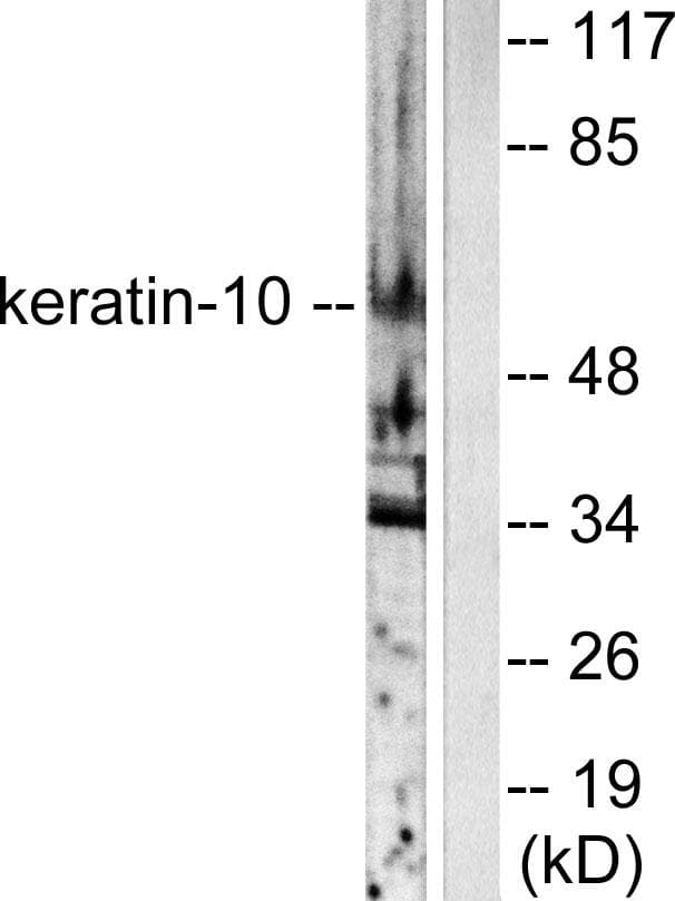Polyclonal Rabbit anti-Human KRT10 / CK10 / Cytokeratin 10 Antibody (IF, WB)