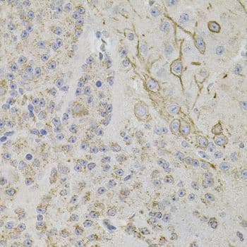 REG3A Antibody