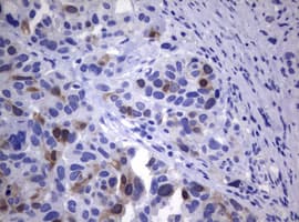TS / Thymidylate Synthase Antibody (clone OTI1A3)