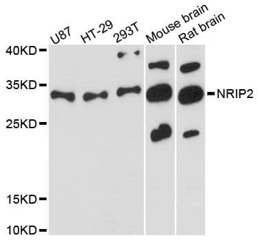 Polyclonal Rabbit anti-Human NRIP2 Antibody (WB)