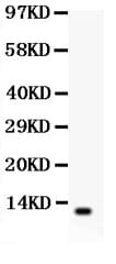 Polyclonal Rabbit anti-Human DEFB1 / BD-1 Antibody (aa52-68, IHC, WB)