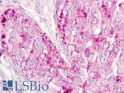 PathPlus™ ACKR2 / CCR10 / D6 Antibody (Internal)