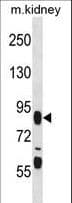 FIGN / Fidgetin Antibody (aa615-643)