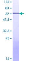 Human XRCC3 Protein (Recombinant GST)