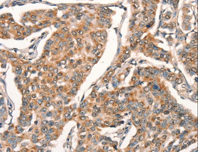 ARFRP1 Antibody