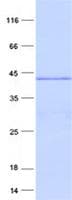 Human CCDC42 Protein (Recombinant His, N-Terminal)