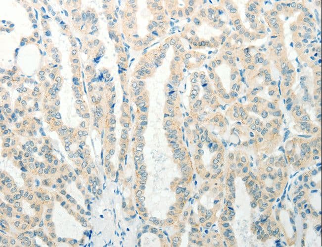 RAB25 Antibody