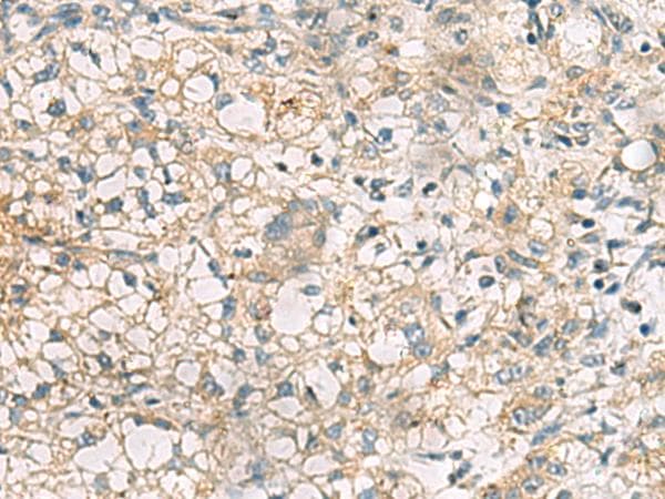 Polyclonal Rabbit anti-Human RTP4 / IFRG28 Antibody (IHC)