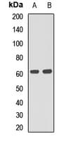 P4HA1 Antibody